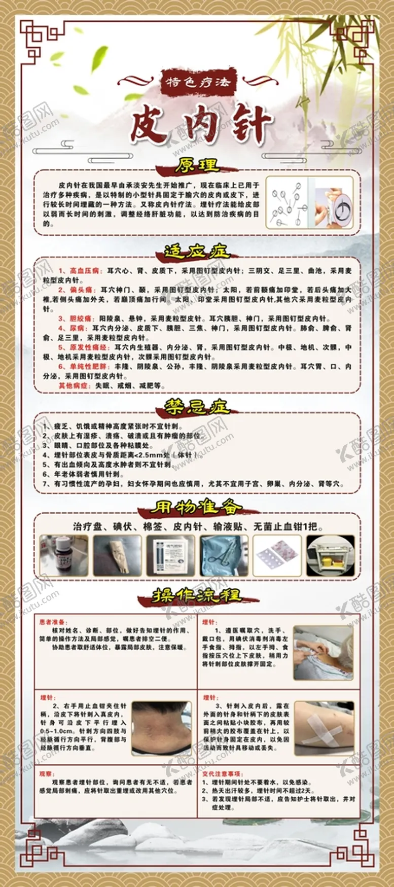 编号：61492501290811072659【酷图网】源文件下载-中医养生疗法-皮内针