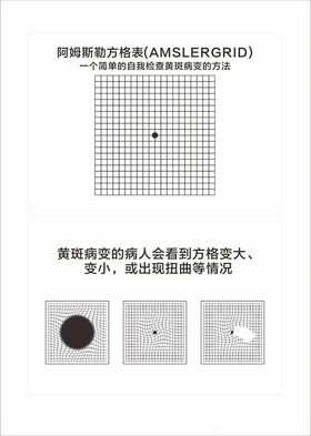 阿姆斯勒方格表