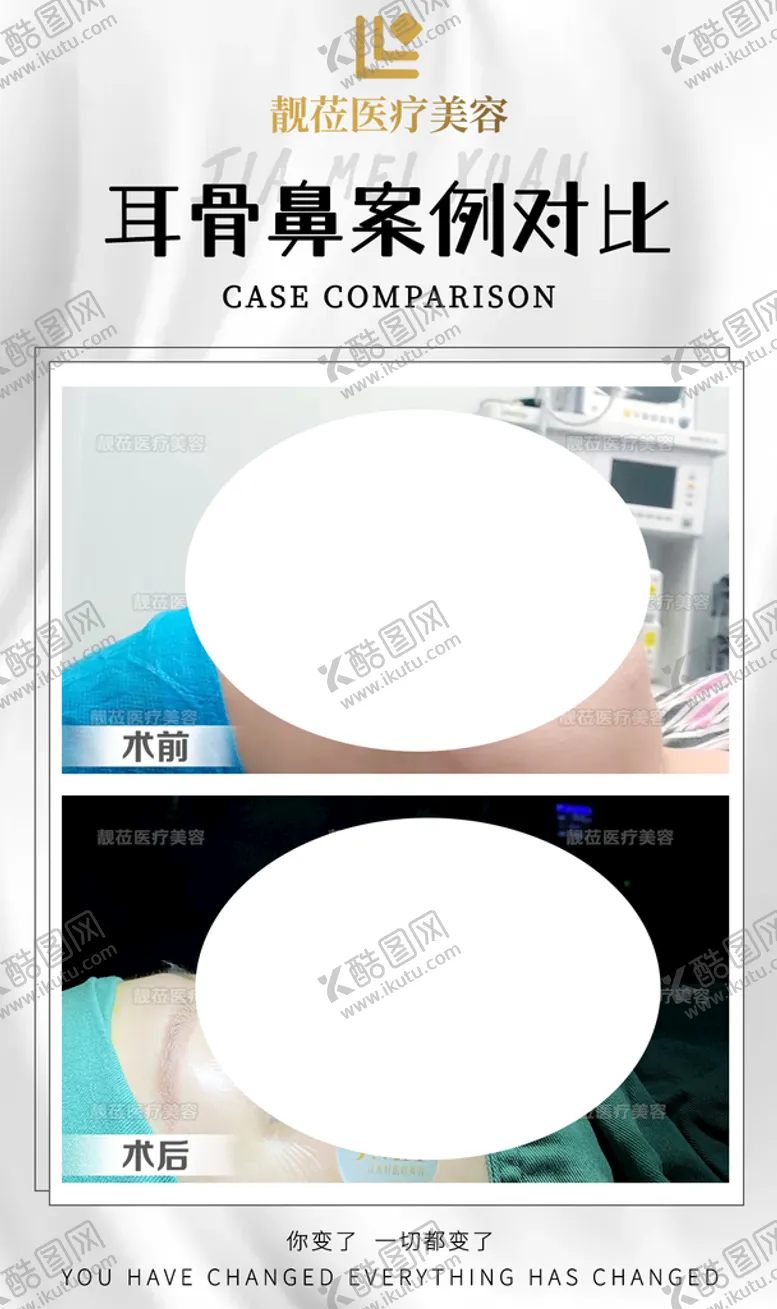 编号：20736809161703262048【酷图网】源文件下载-医美对比案例图