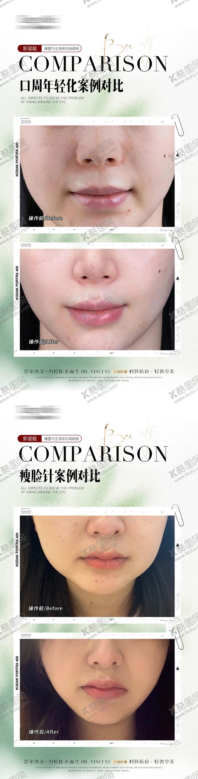 编号：87038709021451264870【酷图网】源文件下载-微整案例