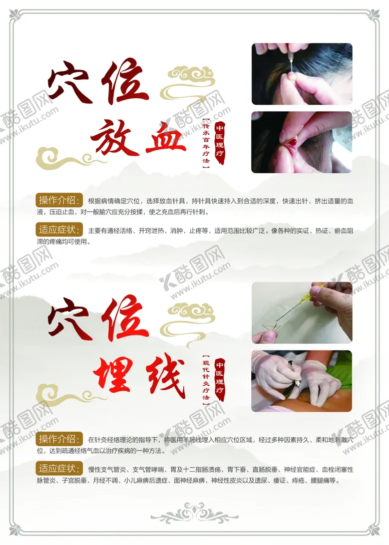 编号：19350403220422011080【酷图网】源文件下载-穴位放血穴位埋线