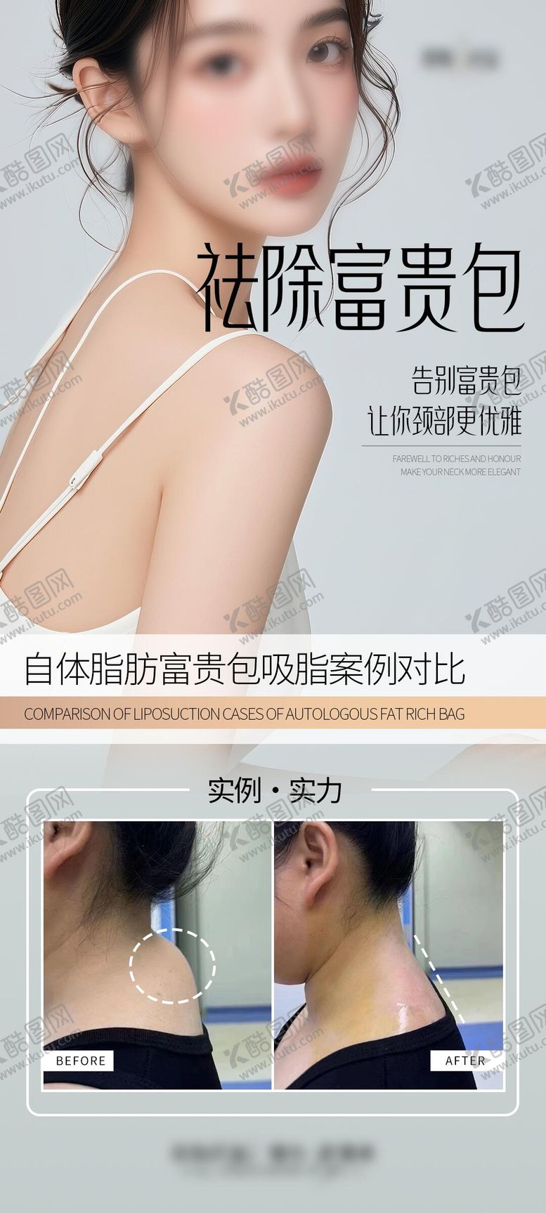 编号：84741305161653508700【酷图网】源文件下载-祛除富贵包案例海报