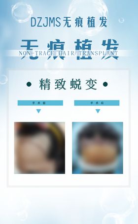 植发案例