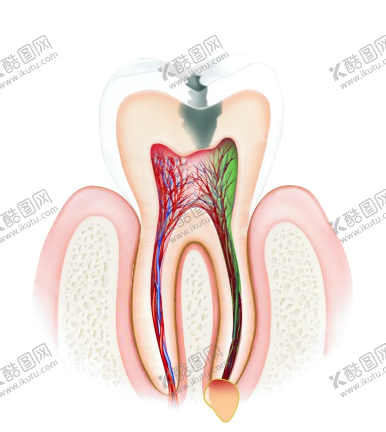 编号：71135506290518348102【酷图网】源文件下载-生病的牙齿