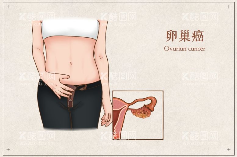 编号：94190112040725069093【酷图网】源文件下载-卵巢癌