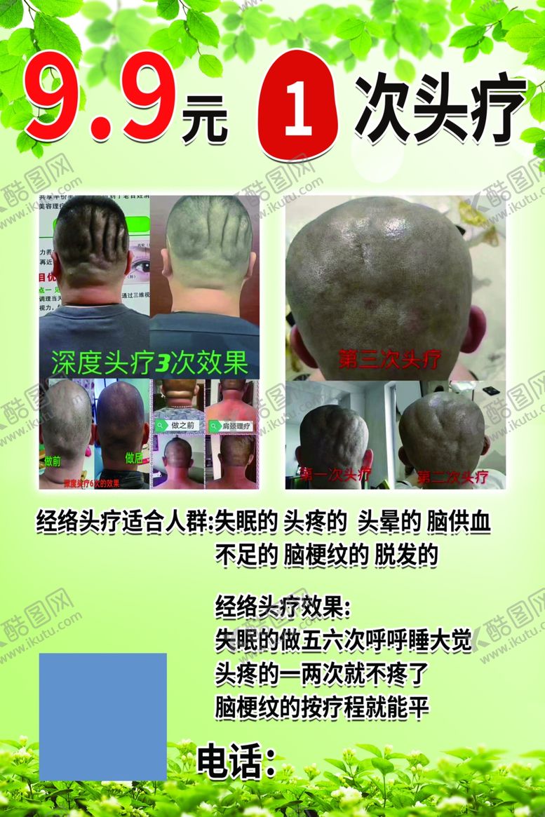 编号：29196801170031138152【酷图网】源文件下载-头疗宣传卡