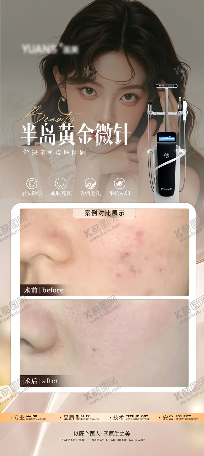 编号：14933506152310359189【酷图网】源文件下载-医美黄金微针祛痘案例海报