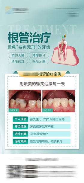 医美口腔牙齿根管治疗对比海报