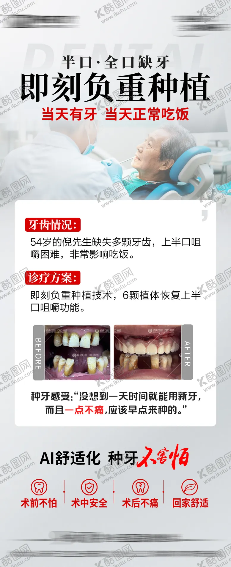 种植牙海报半口案例全口