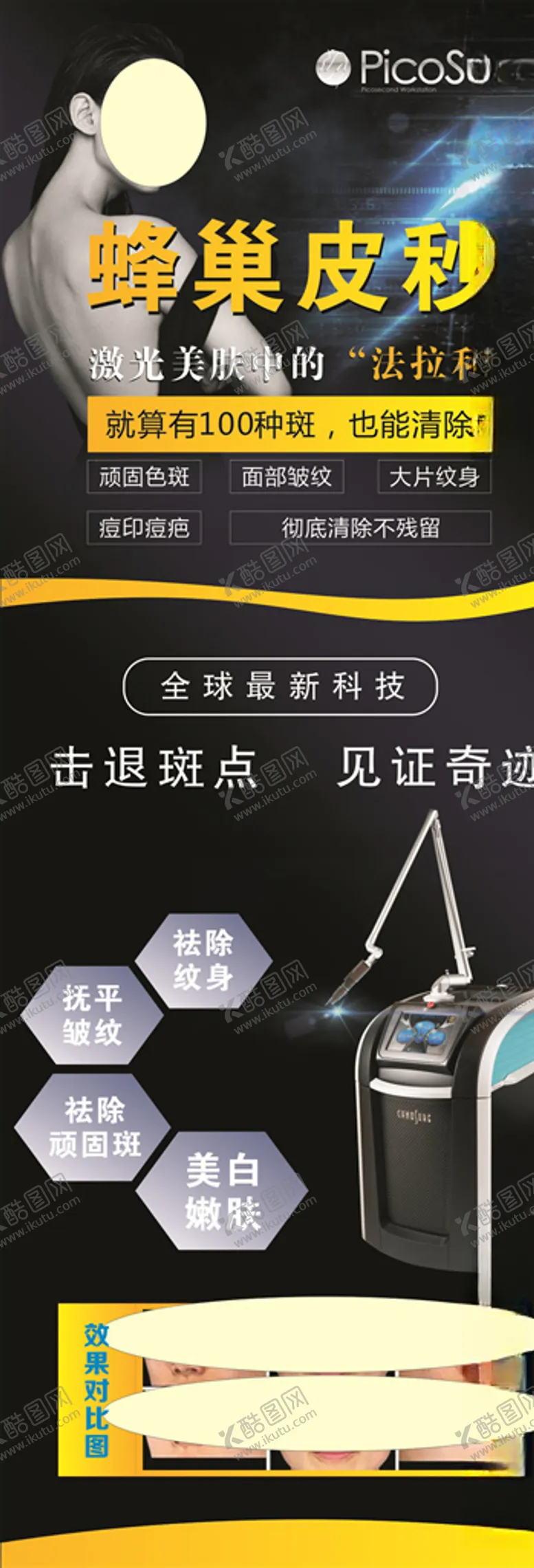 编号：69097906241530274168【酷图网】源文件下载-蜂巢皮秒易拉宝