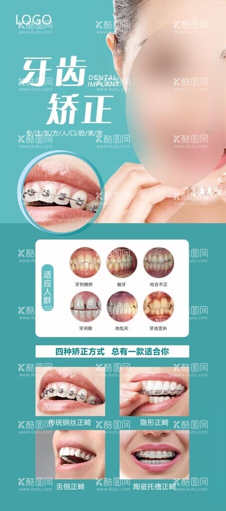 编号：42378803080029215118【酷图网】源文件下载-牙齿矫正