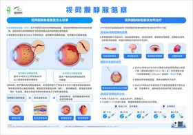 视网膜静脉阻塞