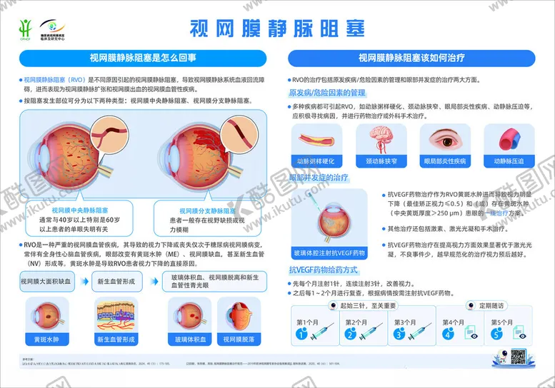 编号：43241505071040204940【酷图网】源文件下载-视网膜静脉阻塞