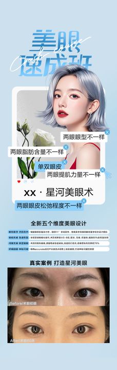 妈生眼案例科普海报