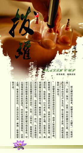 拔罐海报