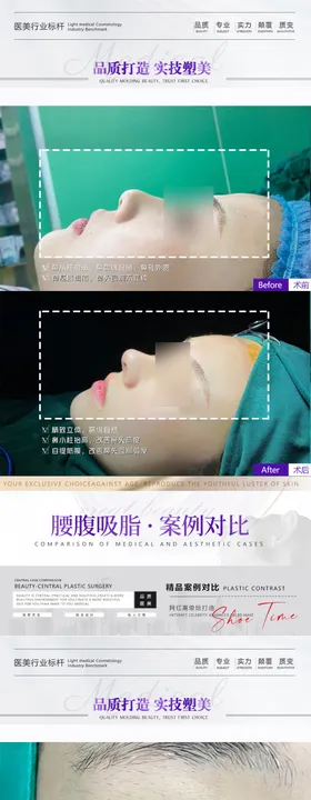 医美眼鼻案例海报