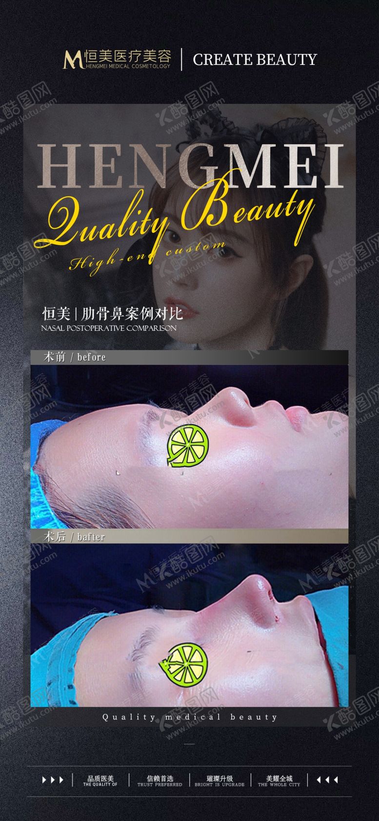 编号：78618501230007591449【酷图网】源文件下载-医美整形案例对比术前术后