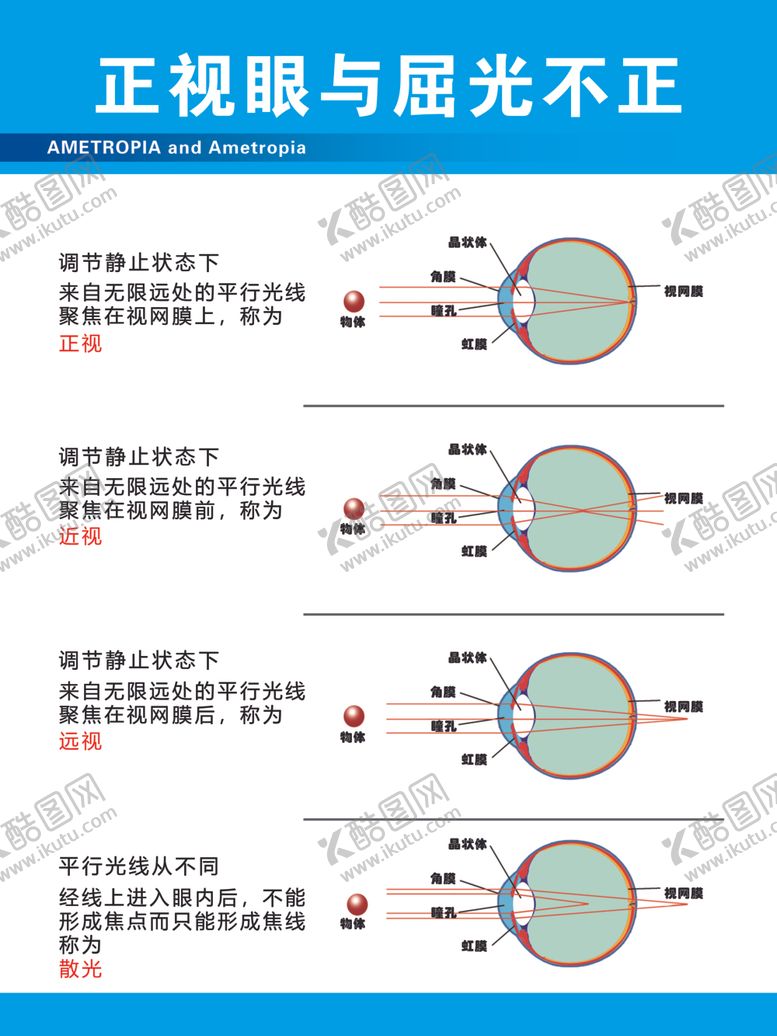 编号：10307102130040168320【酷图网】源文件下载-正视眼与屈光不正