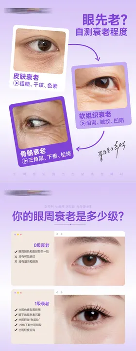 医美美容眼周衰老自测套图