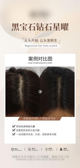 医美头皮抗衰案例海报