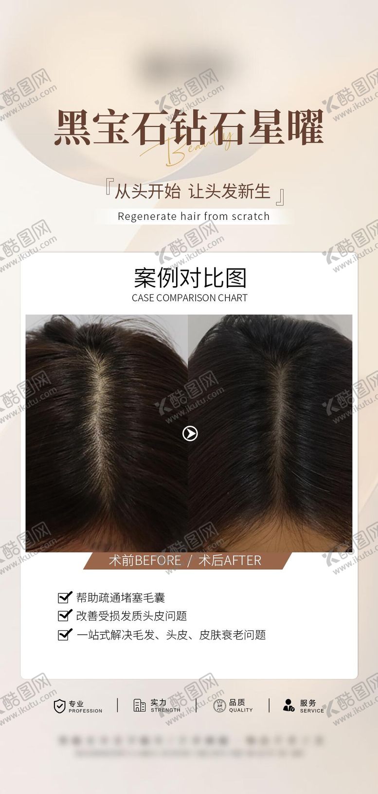 编号：64649712122012364282【酷图网】源文件下载-医美头皮抗衰案例海报