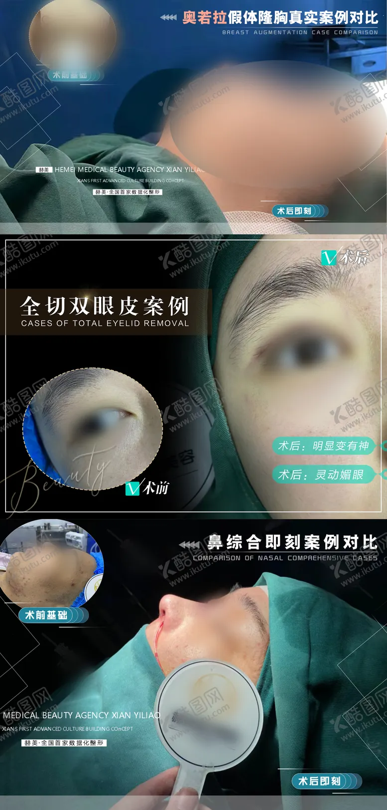 编号：89375112052307509694【酷图网】源文件下载-医美案例对比系列海报展板