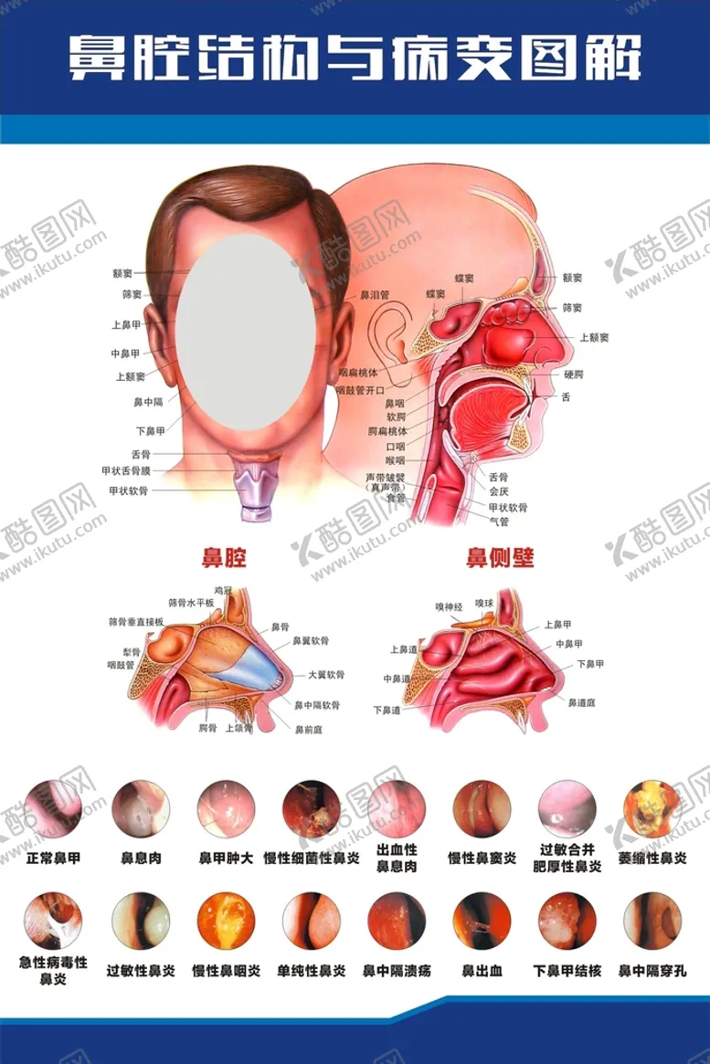 编号：47358010120140587648【酷图网】源文件下载-鼻炎健康 展板