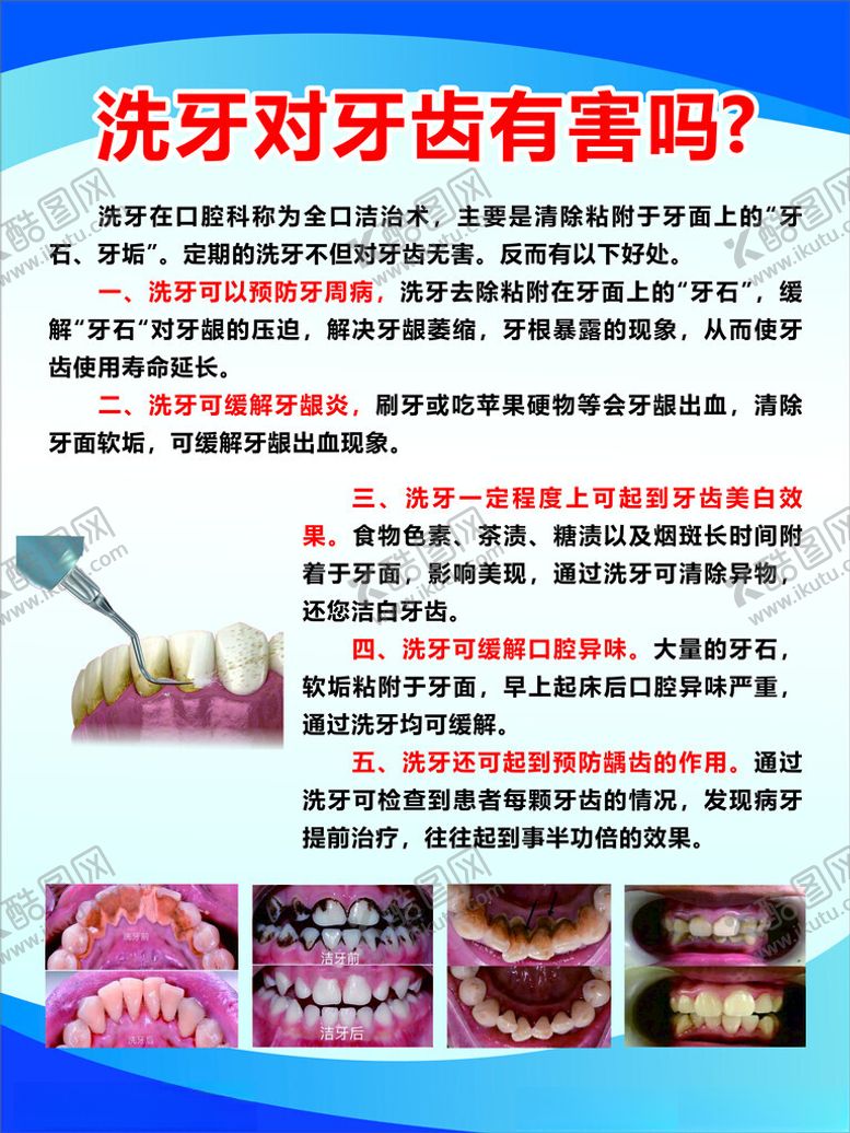 编号：70798602121050575351【酷图网】源文件下载-洗牙对牙齿有害吗