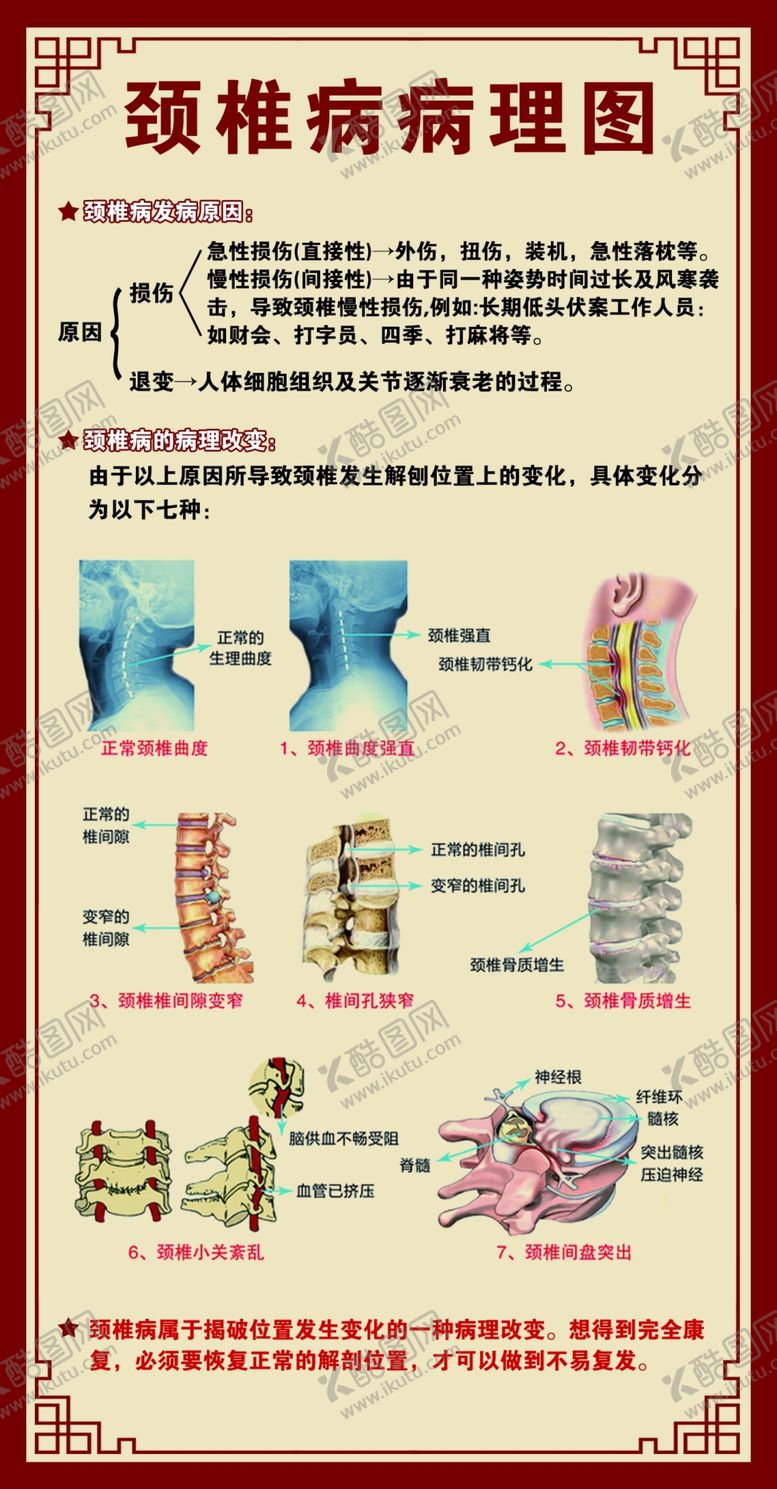 编号：97108102081056571558【酷图网】源文件下载-颈椎病病理图