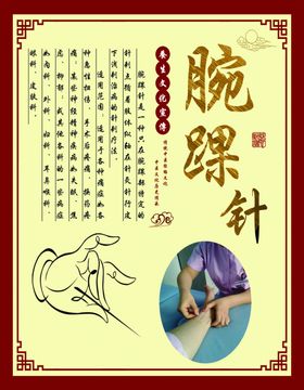 腕踝针