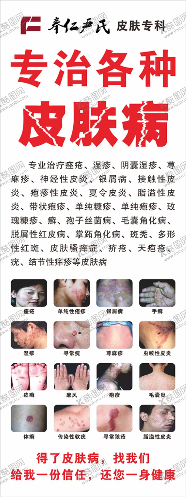 专治各种皮肤病毛囊炎湿疹展架