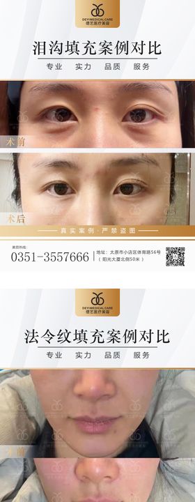 医美案例对比图