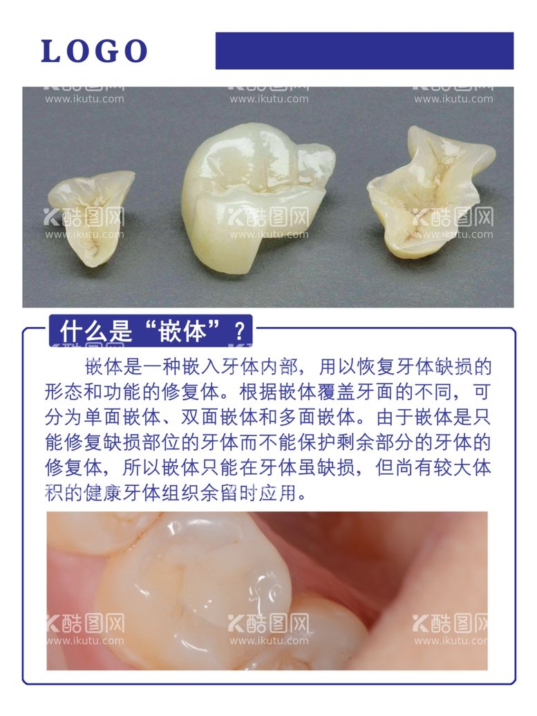 编号：72927603101949057824【酷图网】源文件下载-蓝色口腔科嵌体素材海报