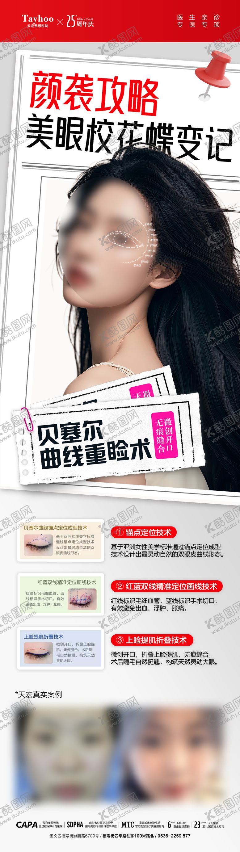 编号：90331204042320456736【酷图网】源文件下载-眼整形案例海报