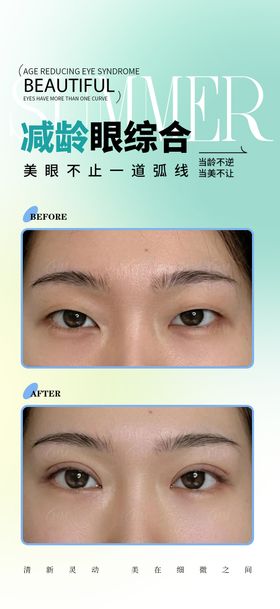 比综合案例