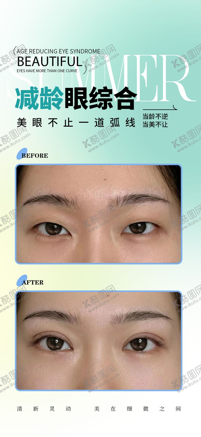编号：75693807070926298958【酷图网】源文件下载-减龄眼综合案例海报