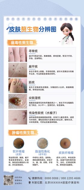 医美病毒性赘生物易拉宝