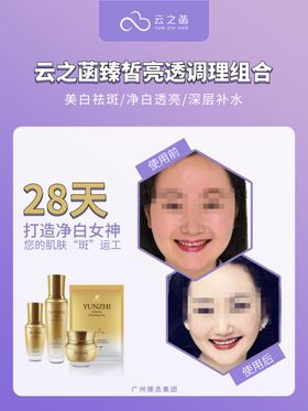 护肤品祛斑效果前后对比