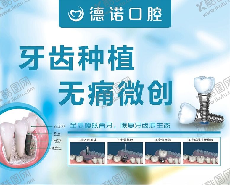 编号：86955102210838523533【酷图网】源文件下载-牙齿种植