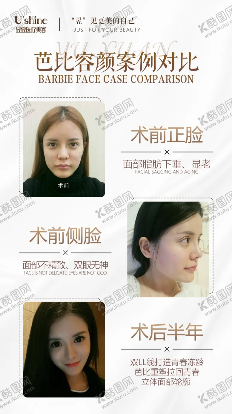 编号：26658806240804225440【酷图网】源文件下载-医美整形医院案例对比海报