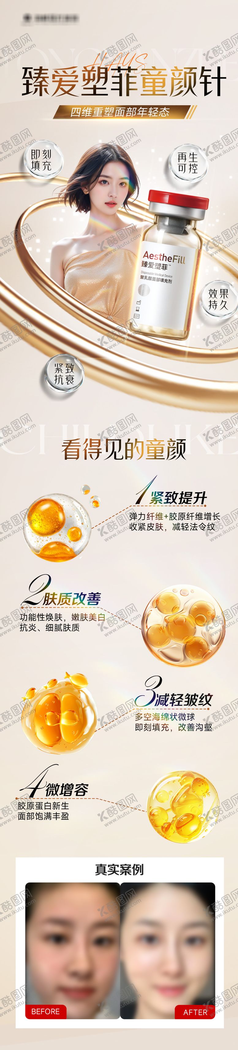 编号：14487711121333439034【酷图网】源文件下载-臻爱塑菲童颜针长图