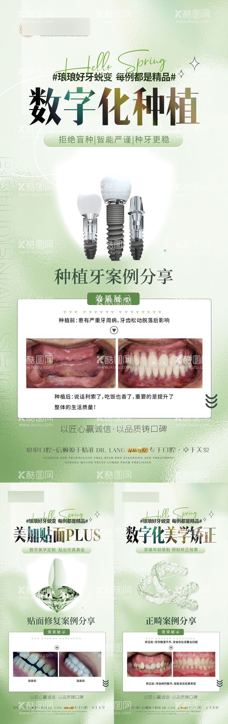 编号：21128511302142495340【酷图网】源文件下载-口腔种植贴面矫正案例海报