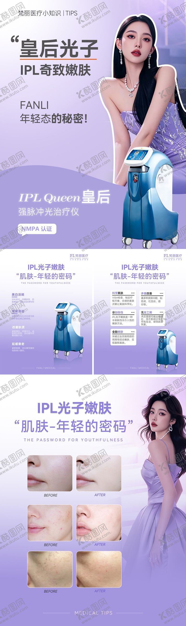编号：95111904031628546808【酷图网】源文件下载-IPL光子嫩肤小红书