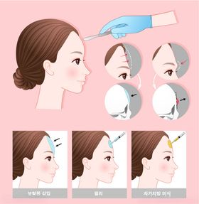 医美插画