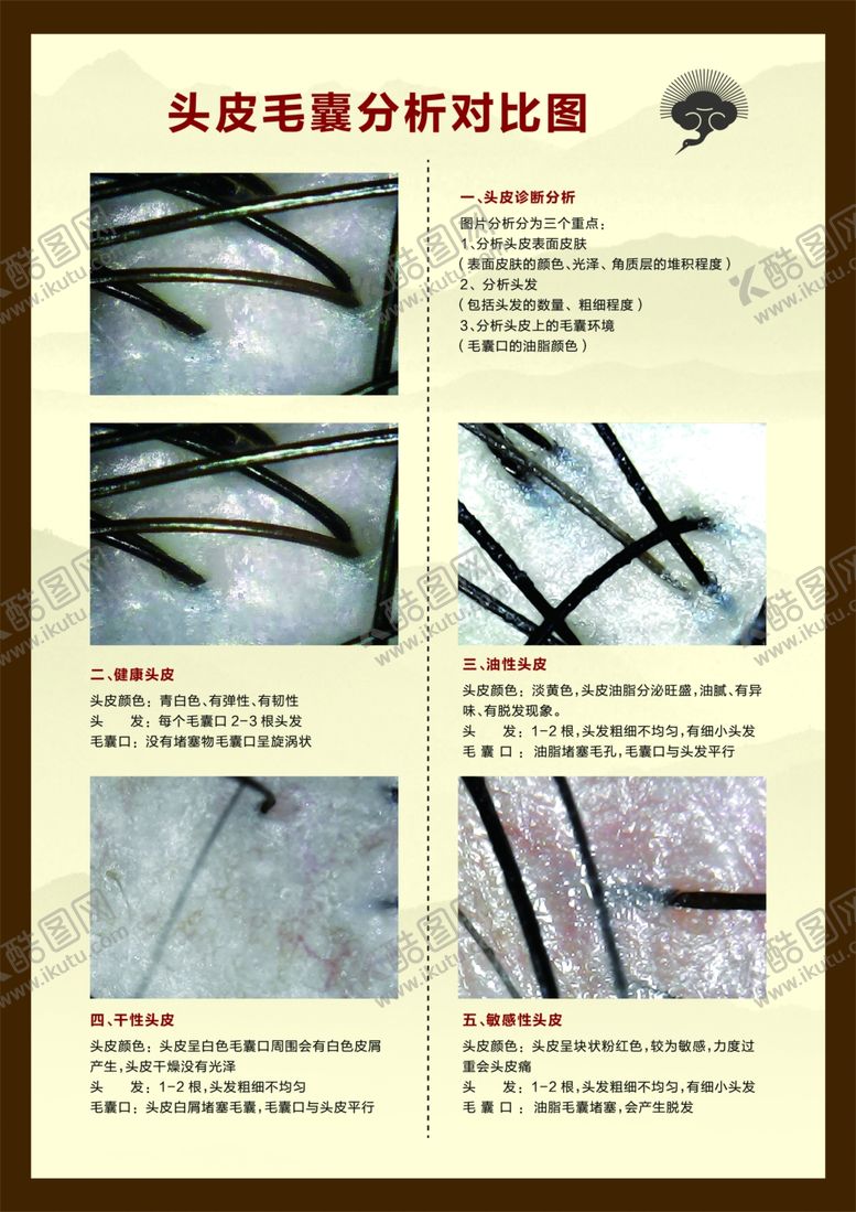 编号：43869909172306335433【酷图网】源文件下载-毛囊对比分析发质对比