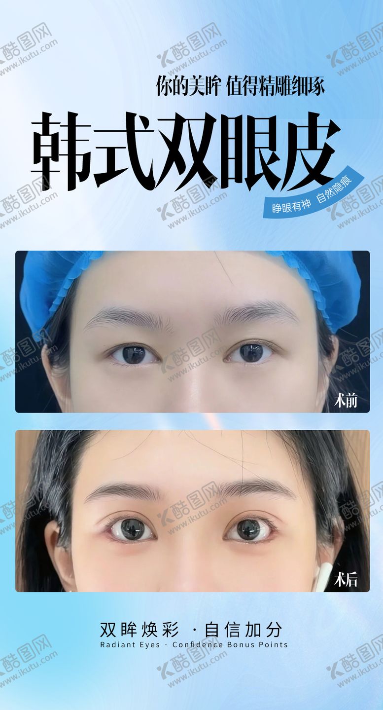 编号：74274511081838044571【酷图网】源文件下载-韩式双眼皮