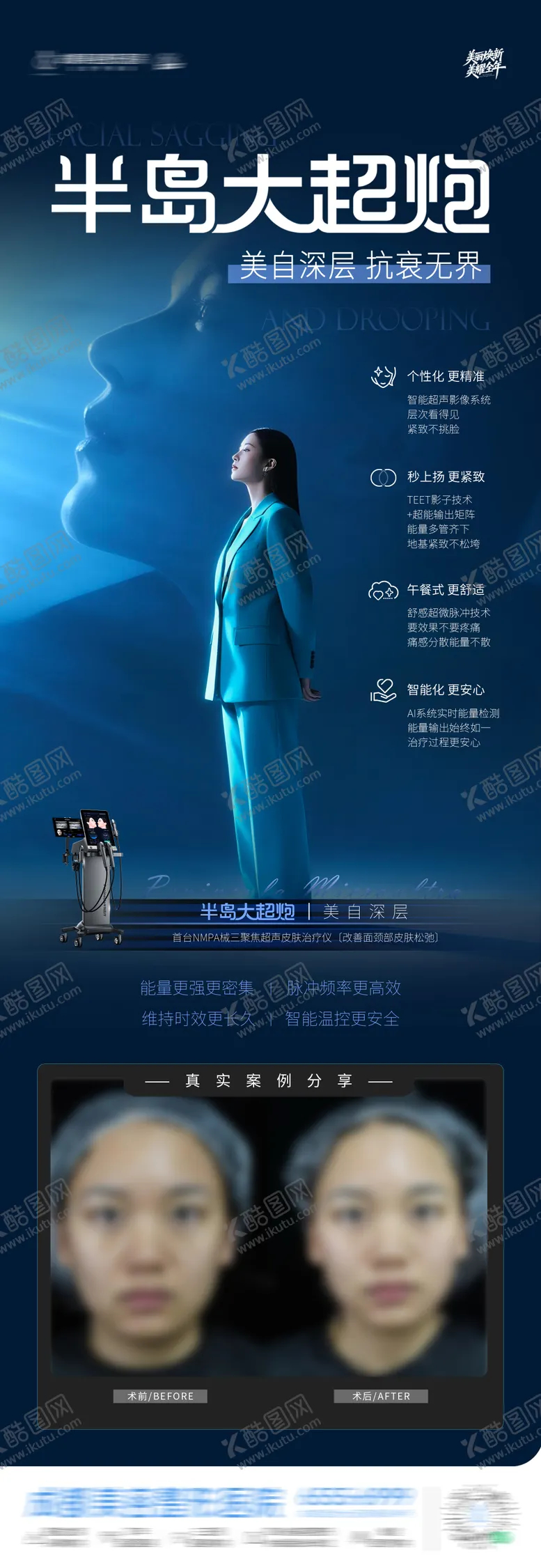 编号：81112601162105541684【酷图网】源文件下载-医美半岛大超炮仪器抗衰案例创意海报