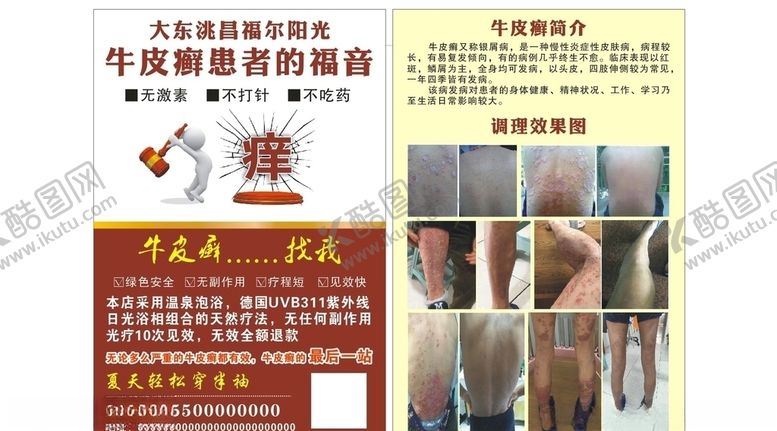 编号：30699110162348571391【酷图网】源文件下载-牛皮癣传单