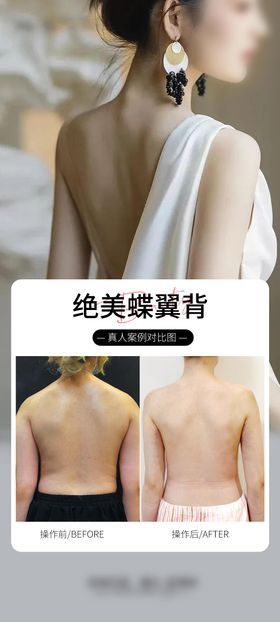美背细腰