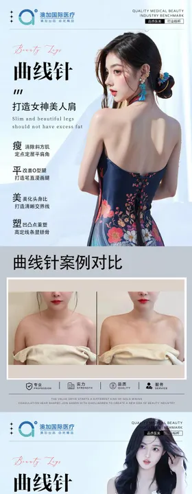 整形案例